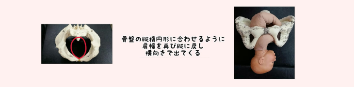 その後縦長の楕円（だえん）形の骨盤を抜けるために再び体を横に向けて、「お誕生日おめでとう！！よく出てきたね～＼(^o^)／」と、なります(^-^)/ 赤ちゃんの体の中で大きいのは頭ですよね。その、大きい頭でママの産道を通ってくるために、五つにわかれた骨を重ね合わせて出てきます。(骨重積っていいます)